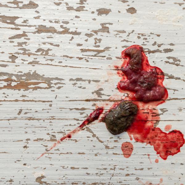 que significa cuando tu perro tiene caca dura